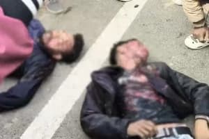 Kolkata Road Accident: बारासात हाईवे पर भीषण सड़क हादसे में दो की मौत, कई घायल