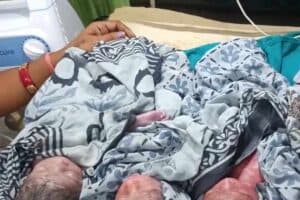 Purnia Four Babies Birth