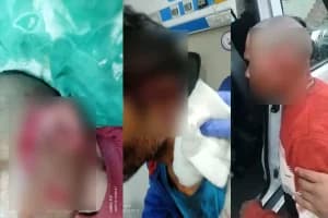 Leopard Attack: तेंदुए के हमले से 4 से 5 लोग घायल, वन विभाग की कोशिशें जारी
