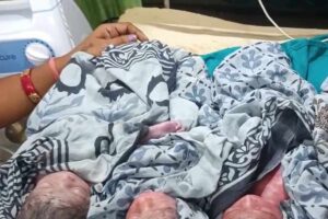 Purnia Four Babies Birth